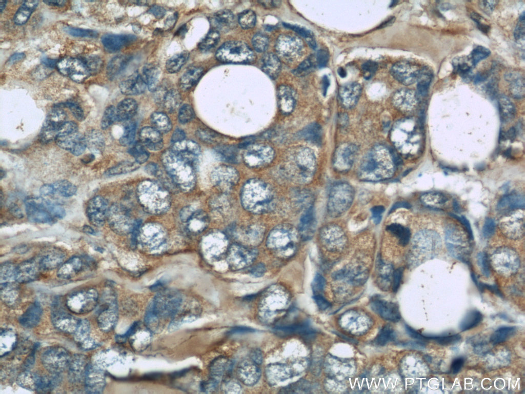 TRPC4AP Monoclonal antibody