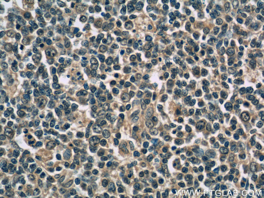 IL-9 Monoclonal antibody
