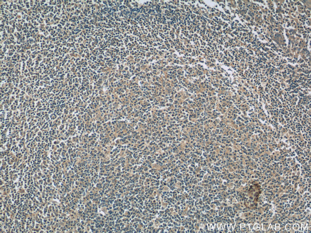 IL-6 Monoclonal antibody