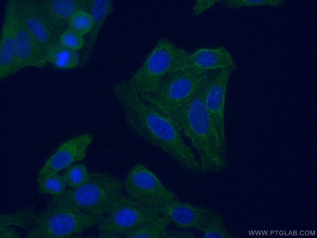 C3/C3b/C3c Monoclonal antibody