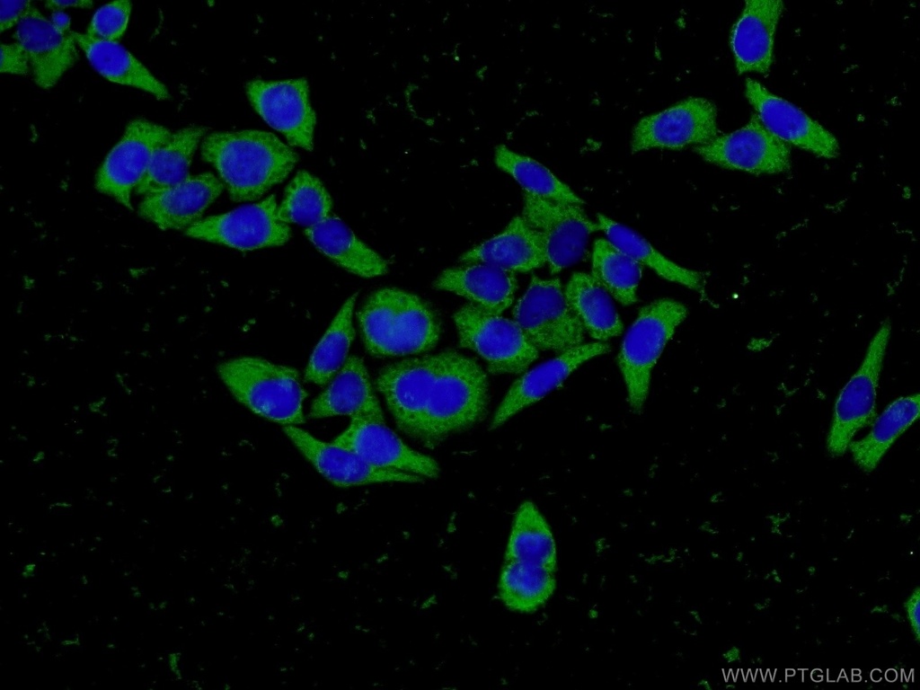 Fibrinogen Gamma Chain Monoclonal antibody