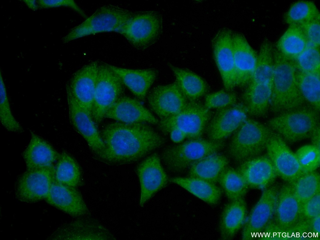 NAPRT1 Monoclonal antibody