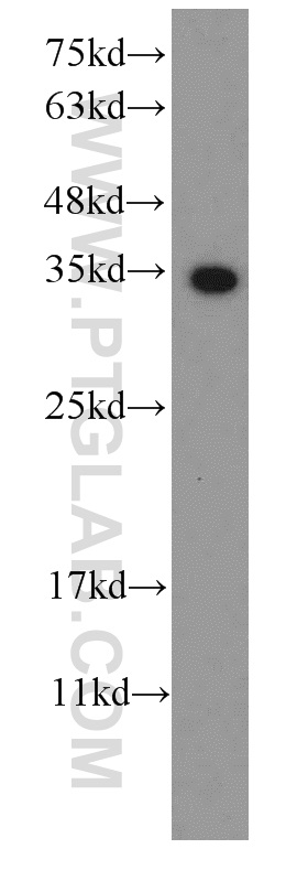 S1 tag Monoclonal antibody