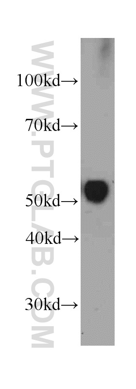 Vitamin D binding protein Monoclonal antibody