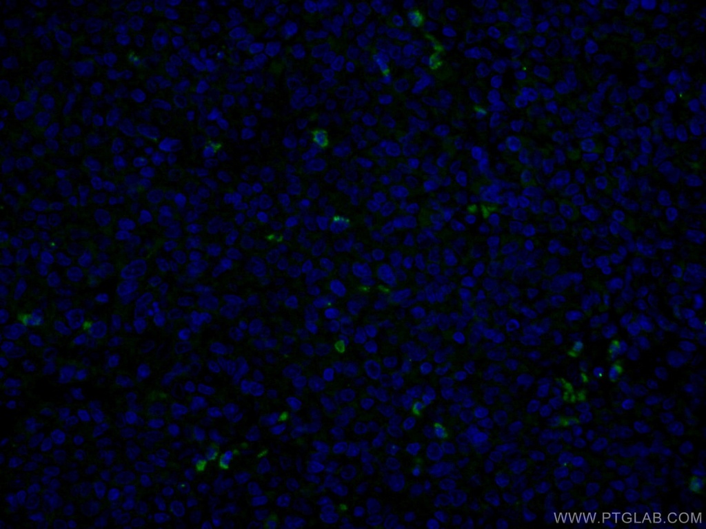 MPO Monoclonal antibody