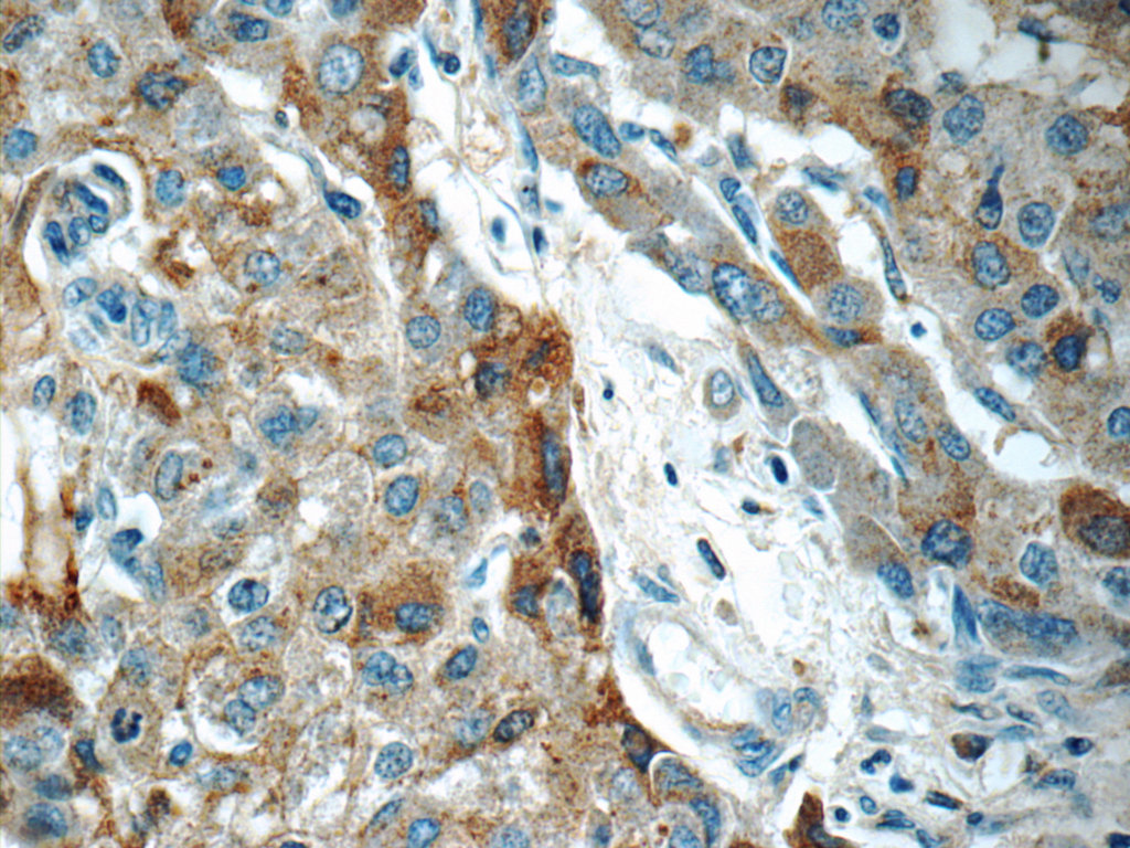 LBP Monoclonal antibody