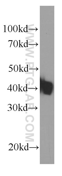 KLF15 Monoclonal antibody