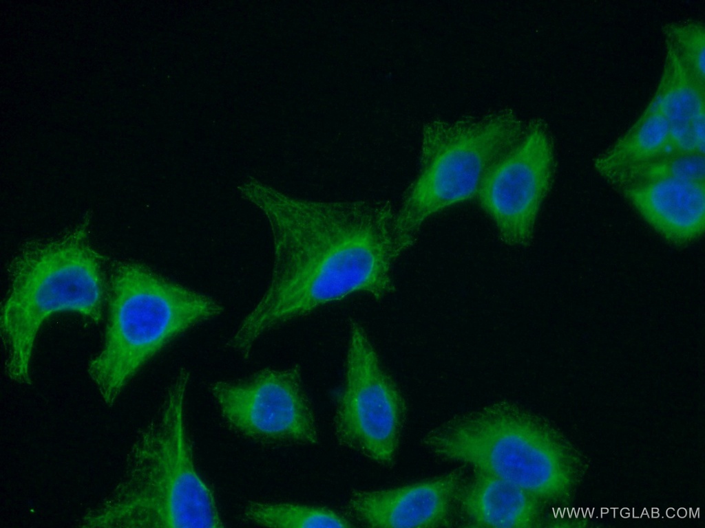 SEPT8 Monoclonal antibody