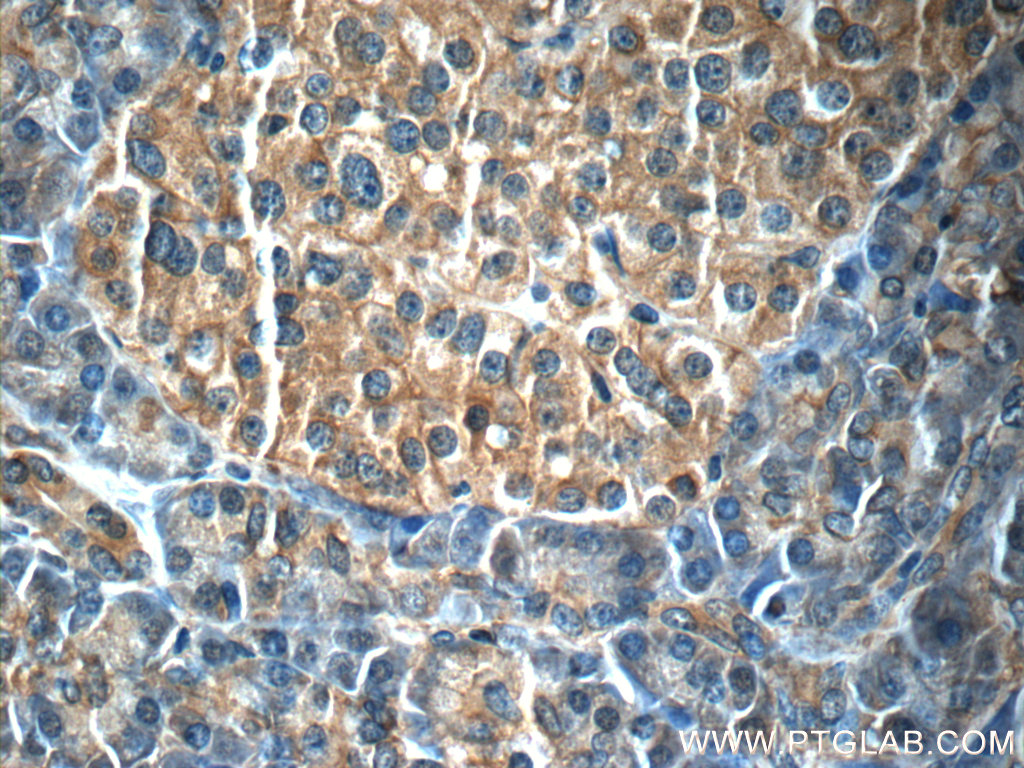 IL-23A Monoclonal antibody
