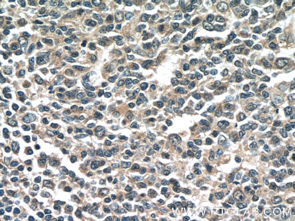NINJ2 Monoclonal antibody