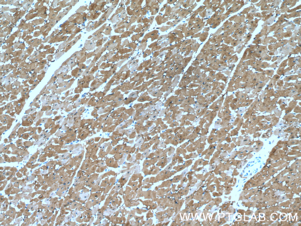 Myoglobin Monoclonal antibody
