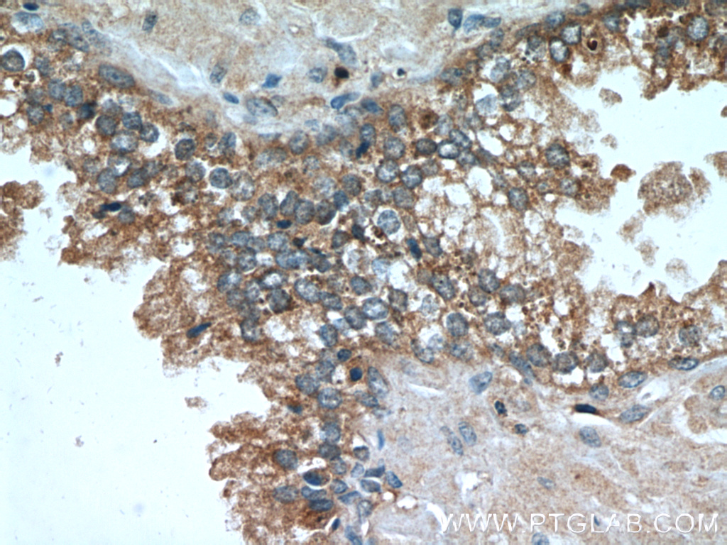 Beta-2-Microglobulin Monoclonal antibody