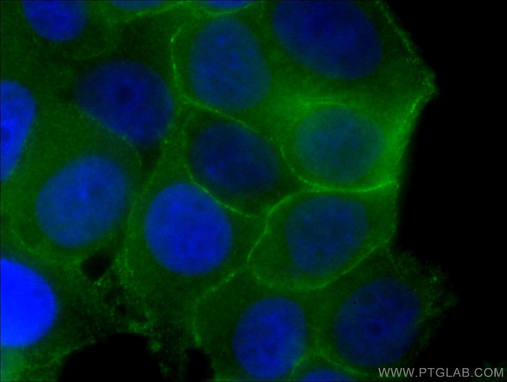 p120 Catenin Monoclonal antibody