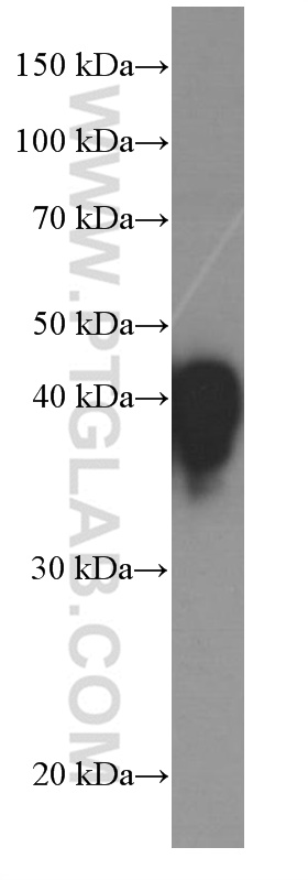 Haptoglobin Monoclonal antibody