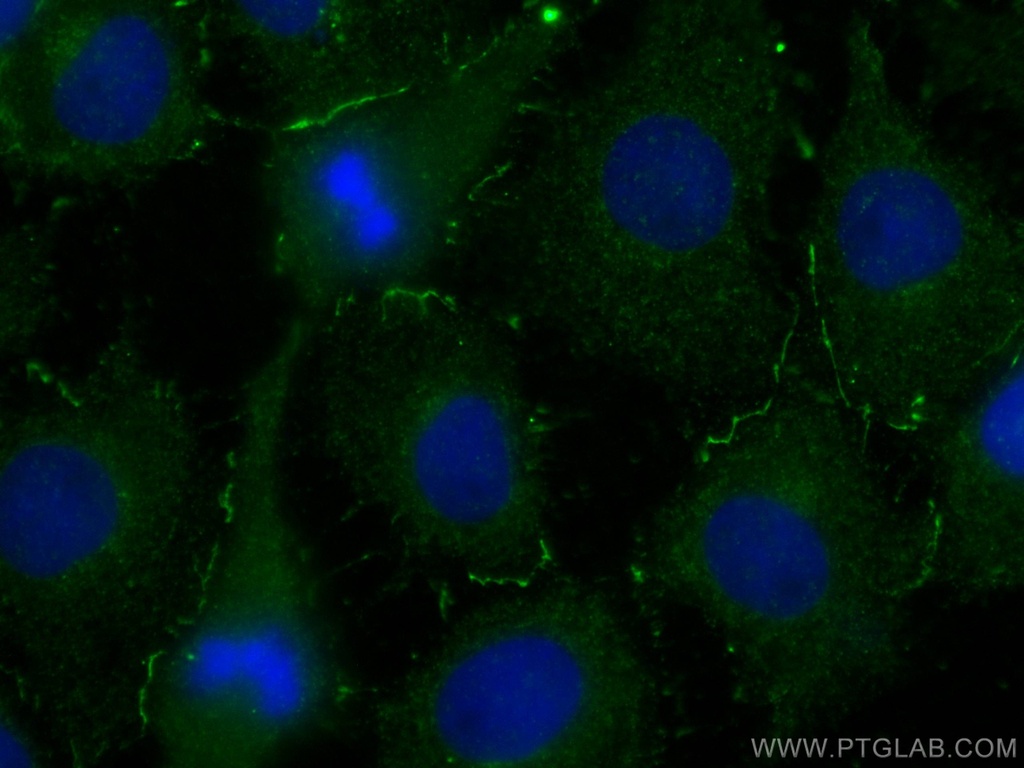 UCHL1/PGP9.5 Monoclonal antibody
