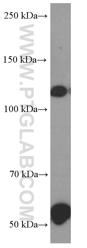 Pikachurin Monoclonal antibody