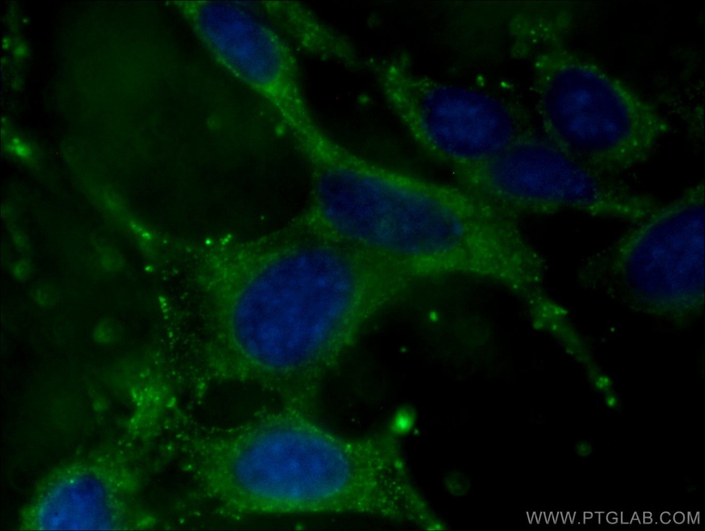 Adiponectin Monoclonal antibody
