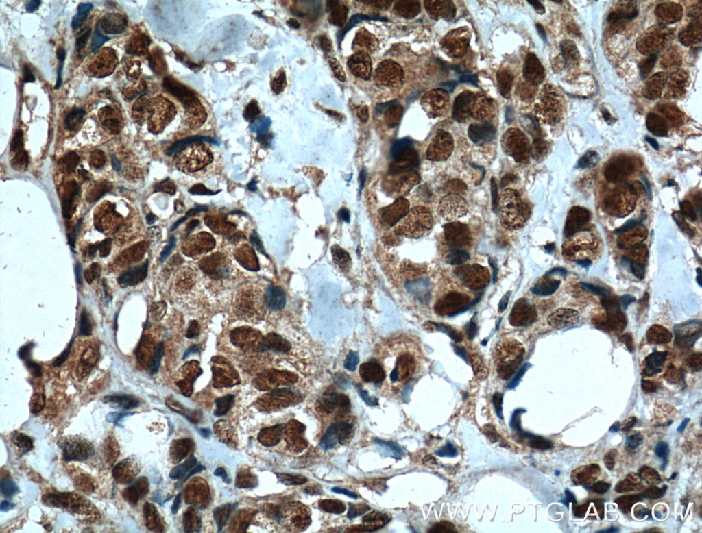 IMP3 Monoclonal antibody