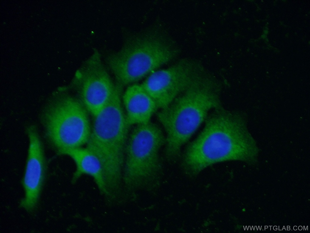 TRIM44 Monoclonal antibody
