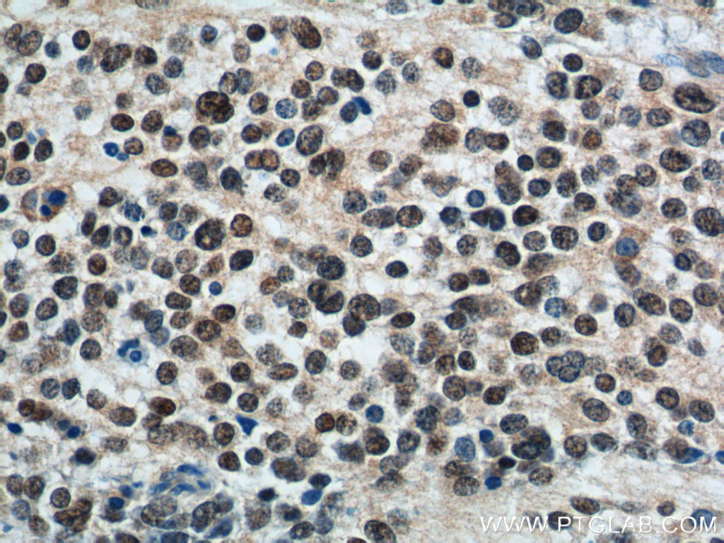 PHOX2B Monoclonal antibody