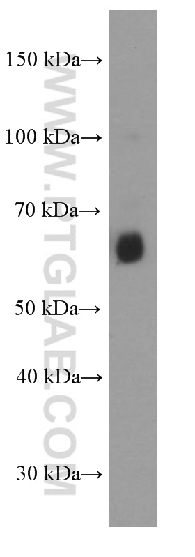 AIRE Monoclonal antibody