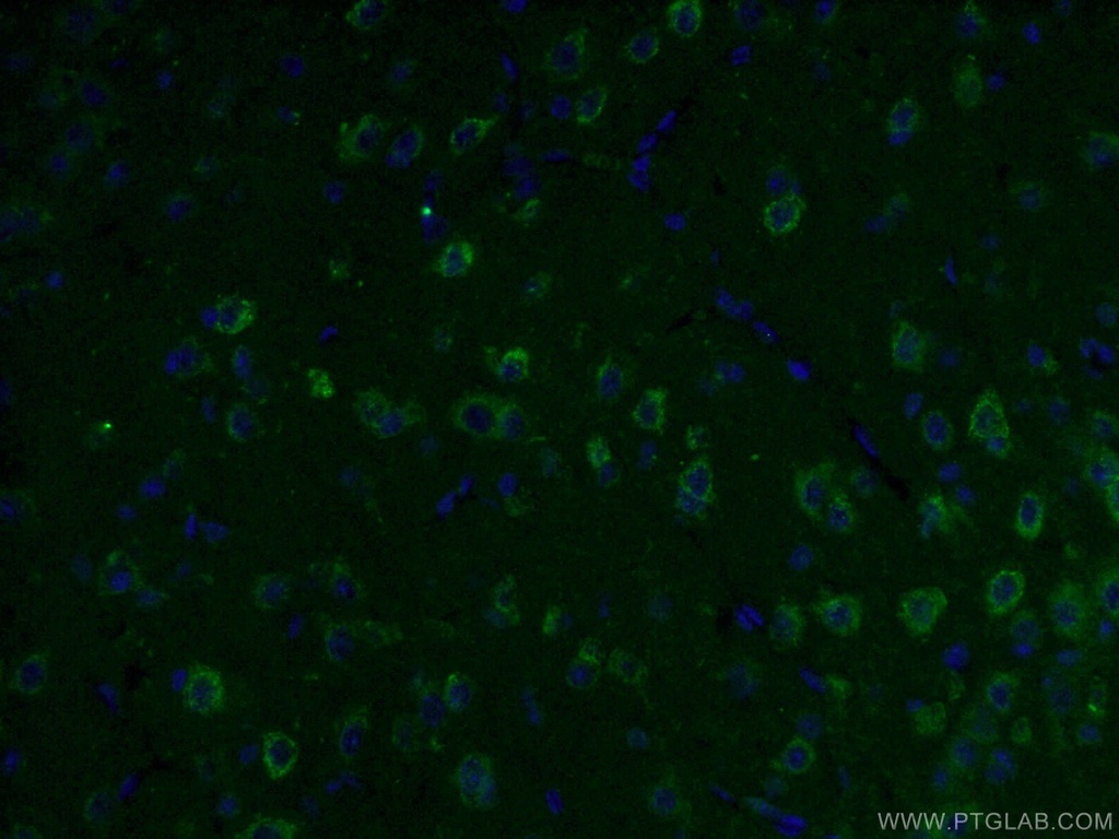 KGA/GAC Monoclonal antibody