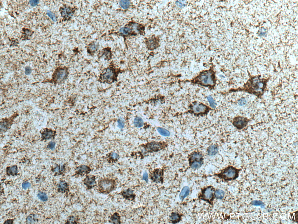 KGA-Specific Monoclonal antibody