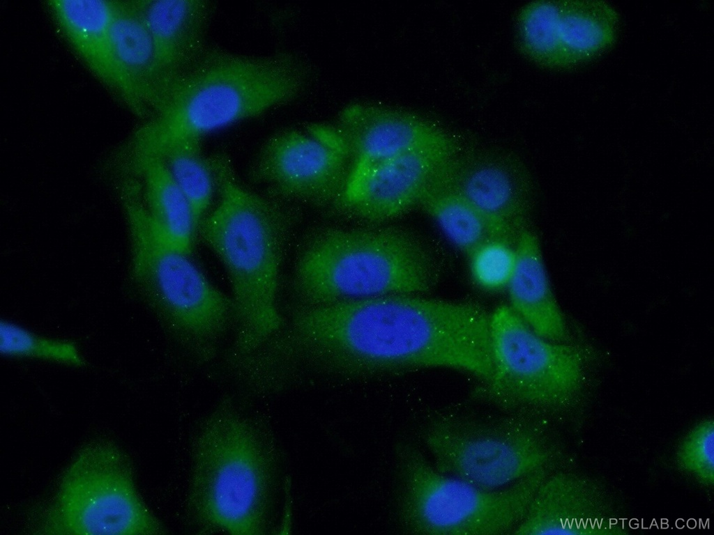 SRPX2 Monoclonal antibody