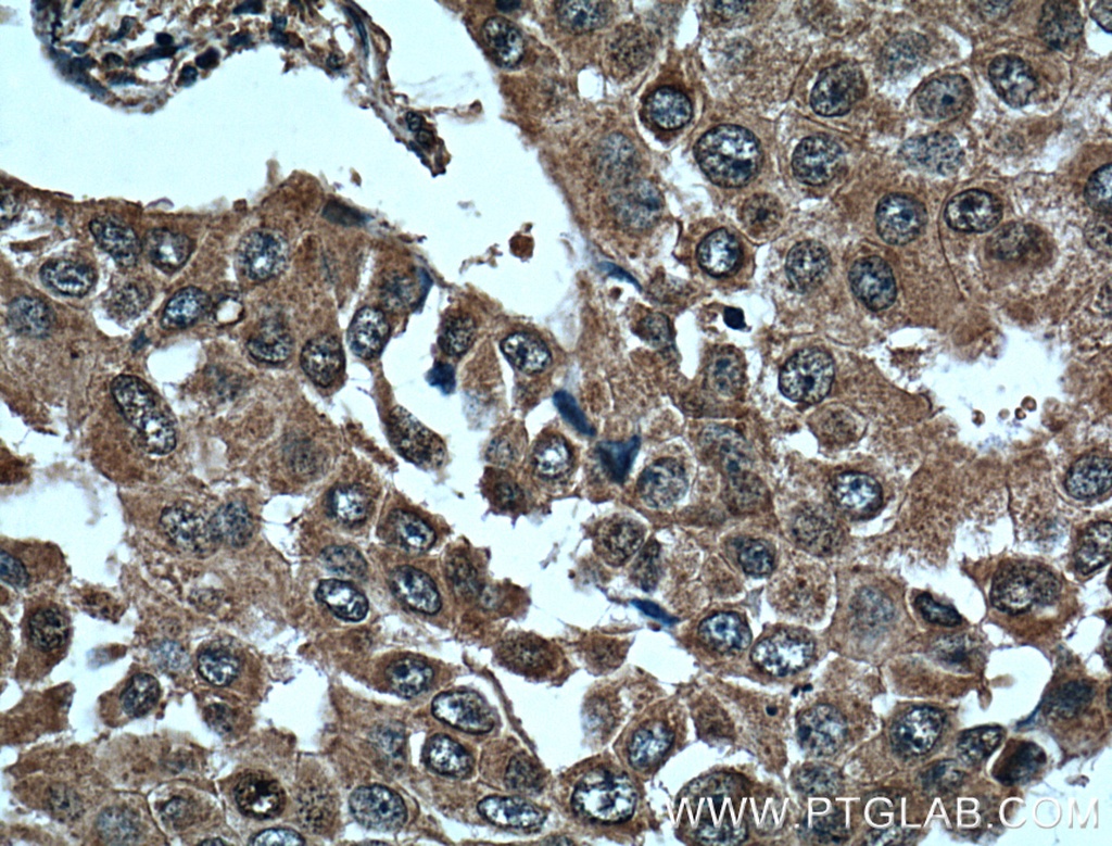 L2HGDH Monoclonal antibody