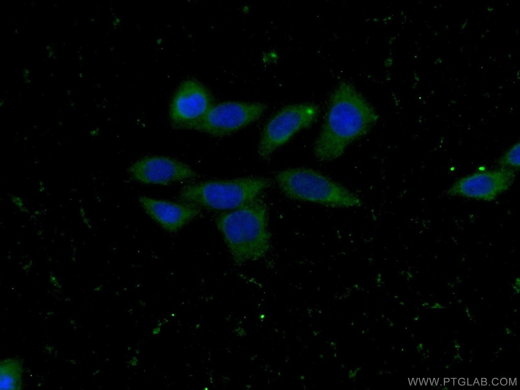 CLTB Monoclonal antibody