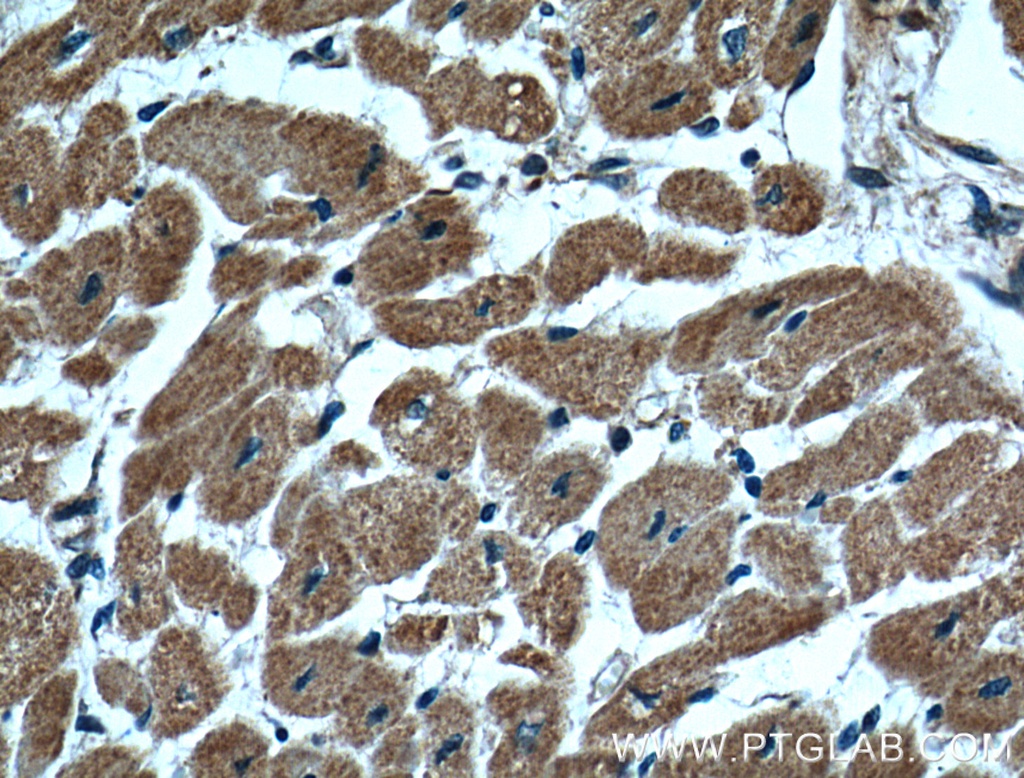 CLPP Monoclonal antibody