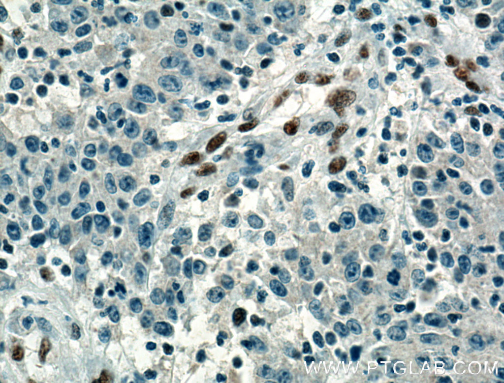 ZEB1 Monoclonal antibody