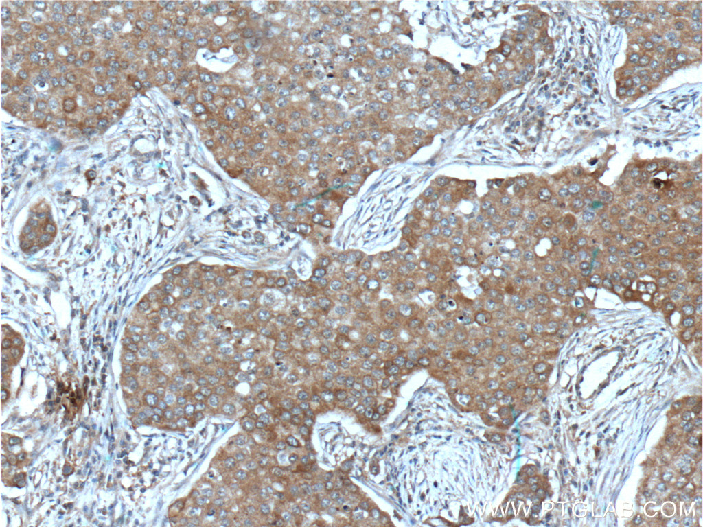 IGF1R Beta Chain Monoclonal antibody