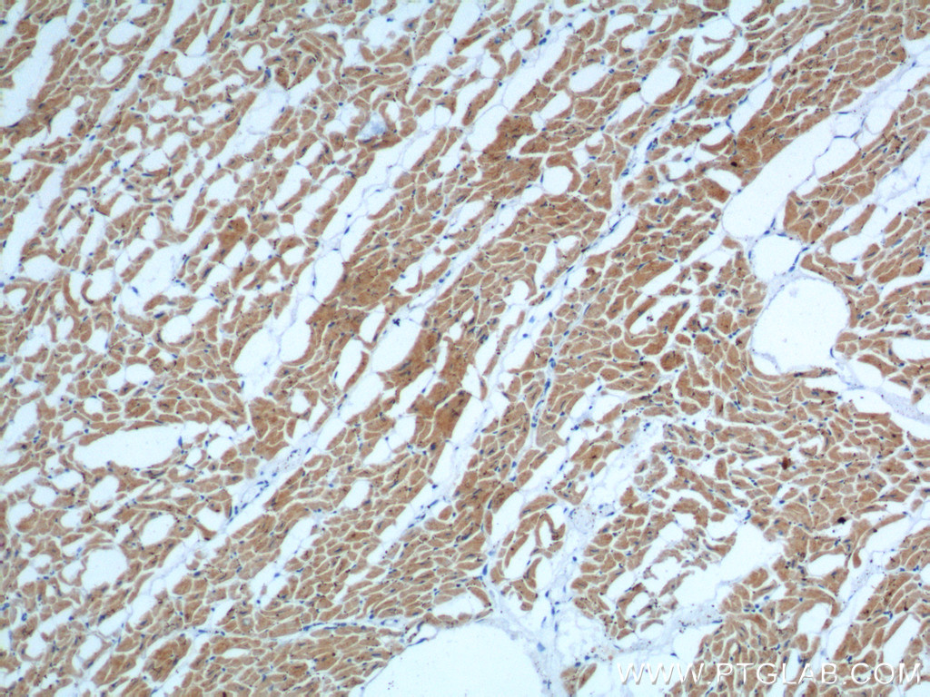 MYL3 Monoclonal antibody