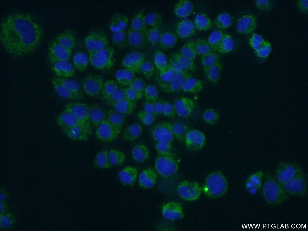 BDNF Monoclonal antibody