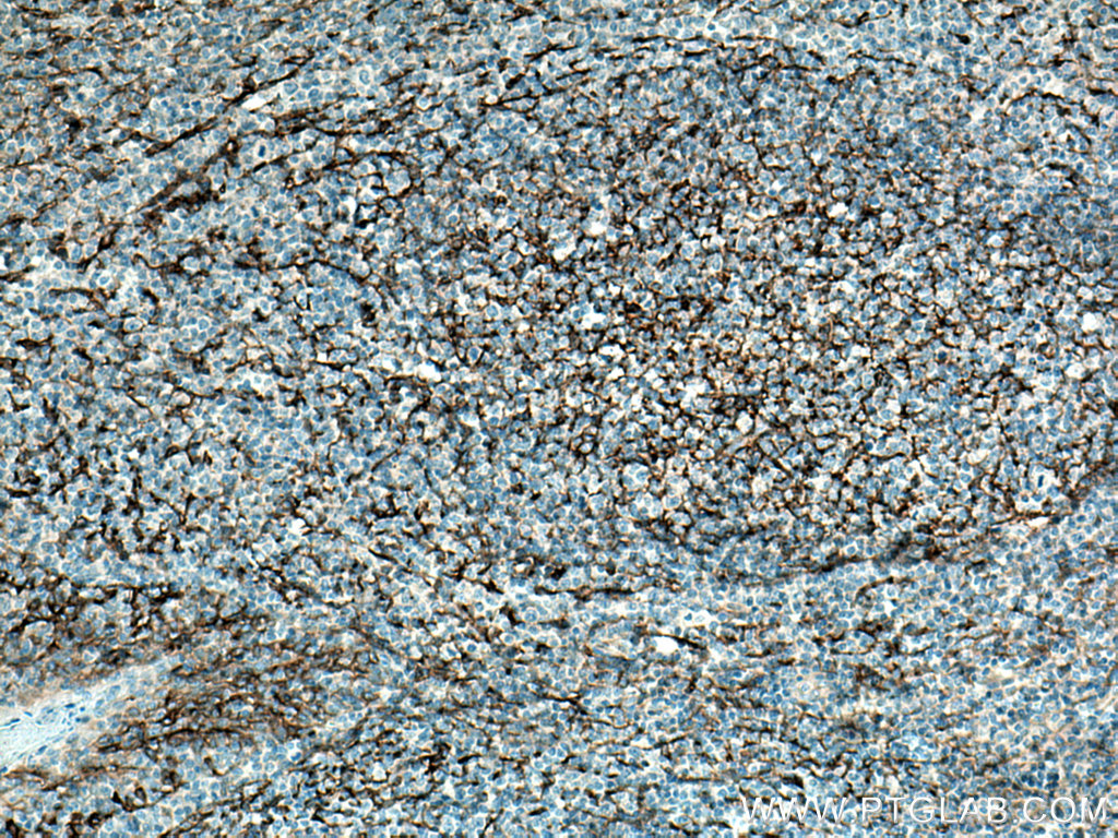 VCAM-1 Monoclonal antibody