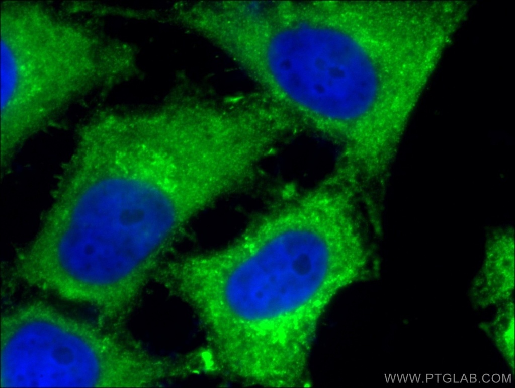 Sestrin 2 Monoclonal antibody