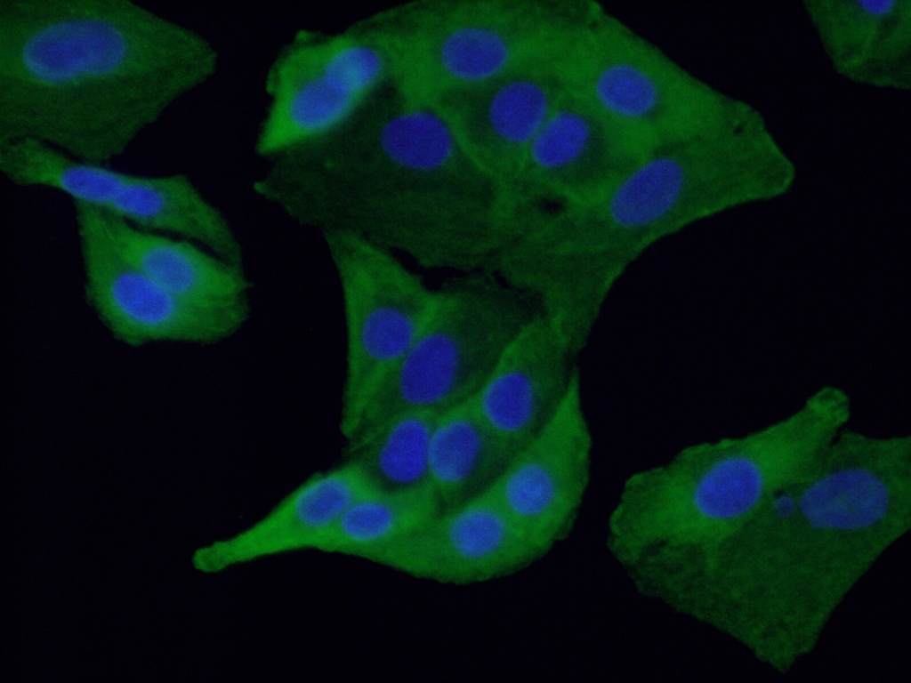 RSPO3 Monoclonal antibody