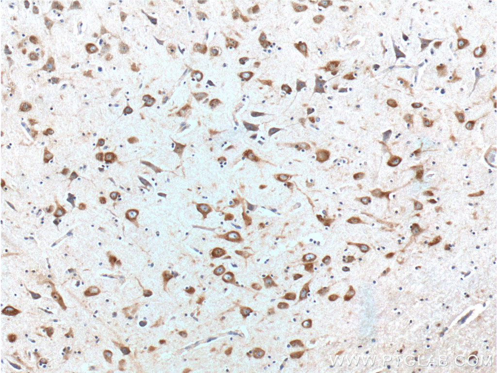 Peripherin Monoclonal antibody