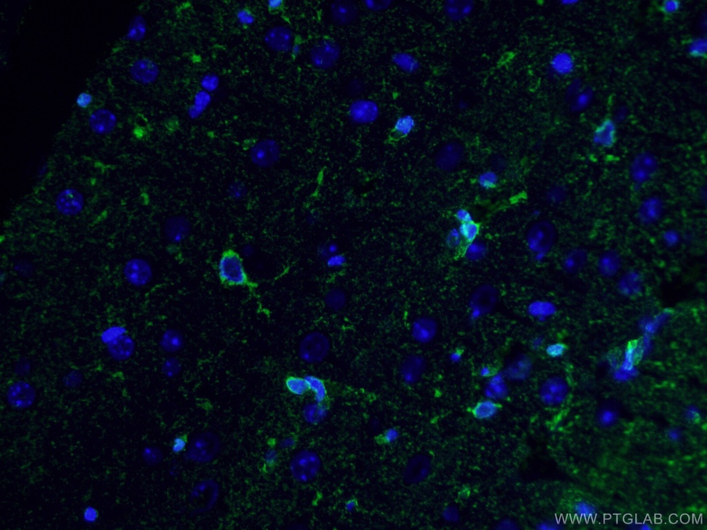 Glutamine Synthetase Monoclonal antibody