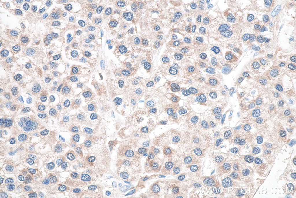 Glutamine Synthetase Monoclonal antibody
