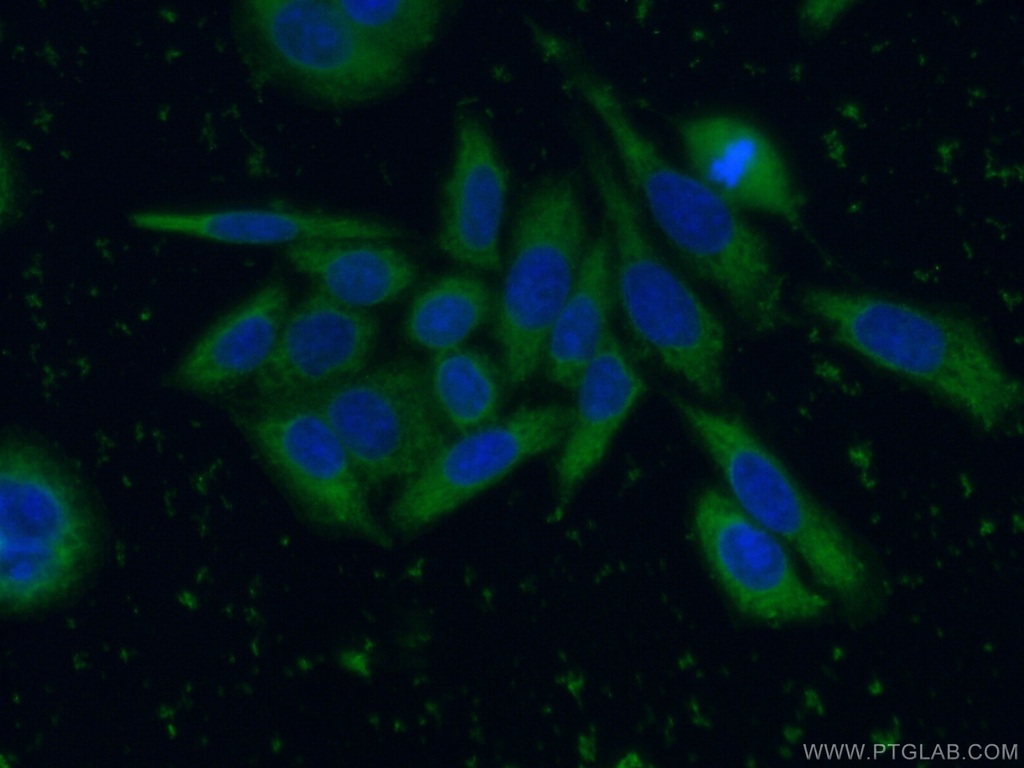 SRD5A1 Monoclonal antibody