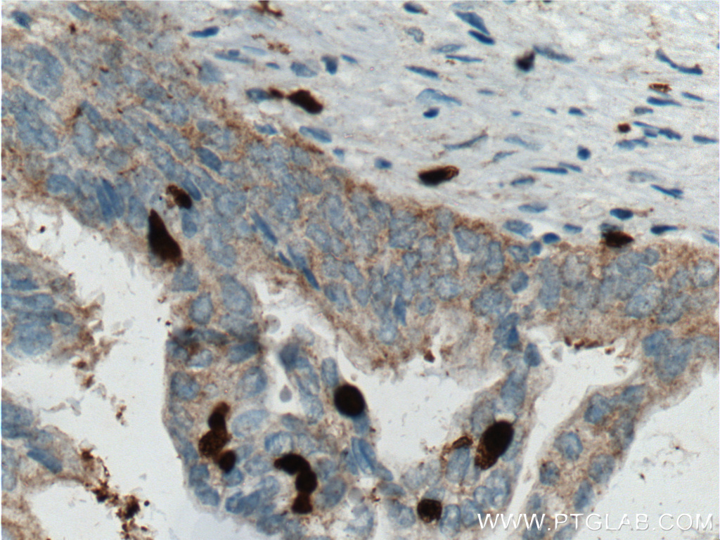 SMYD3 Monoclonal antibody
