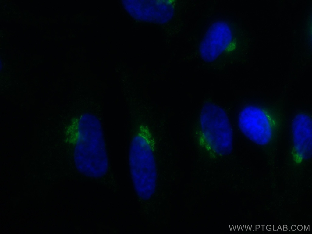 GP73/GOLPH2 Monoclonal antibody
