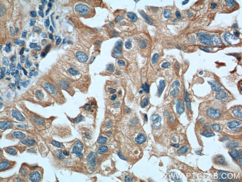 IGSF2 Monoclonal antibody