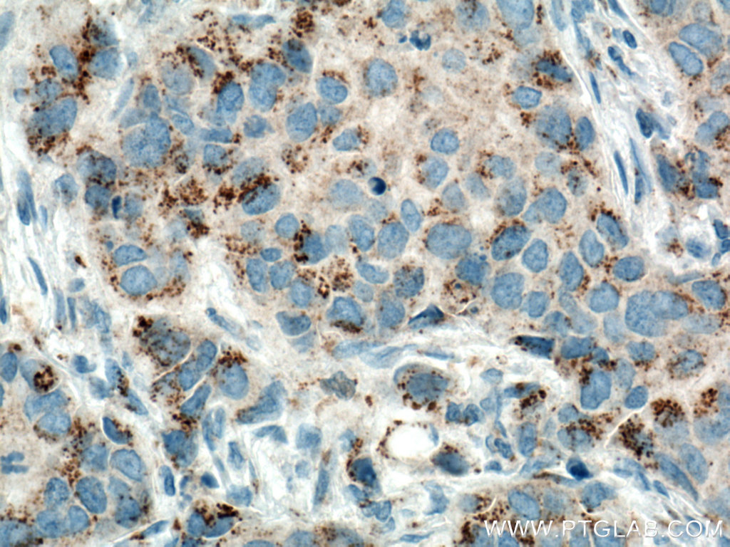 MMP3 Monoclonal antibody