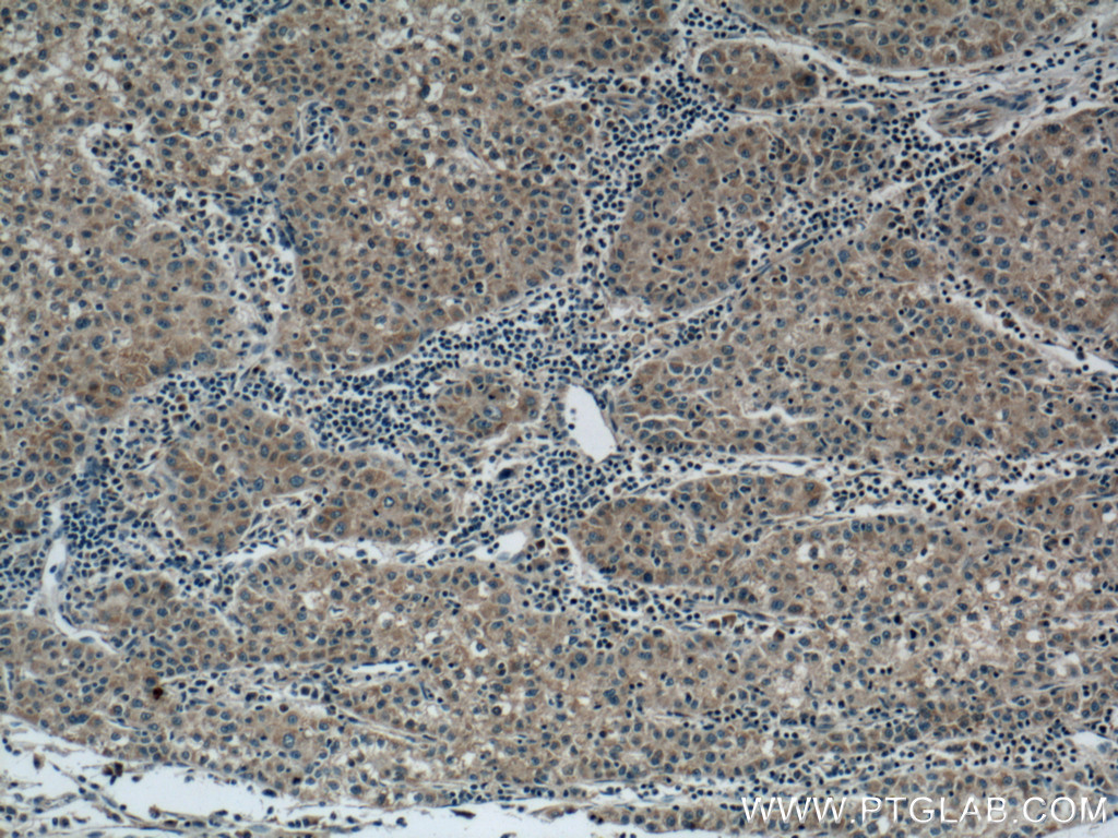 RAB5A Monoclonal antibody