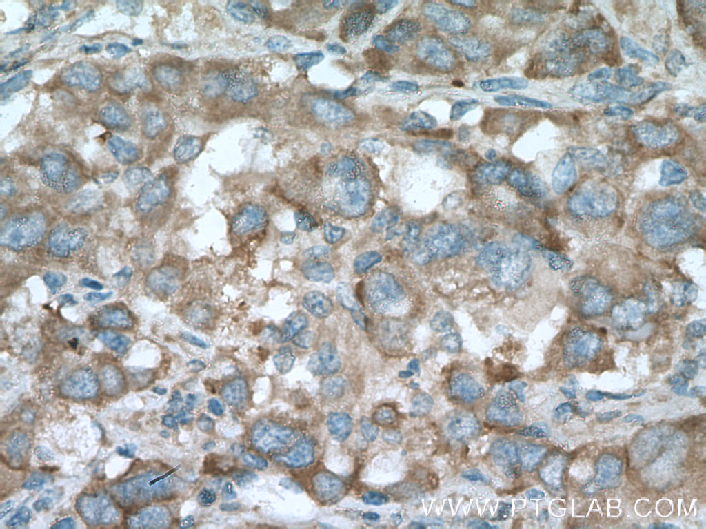 PLOD2 Monoclonal antibody