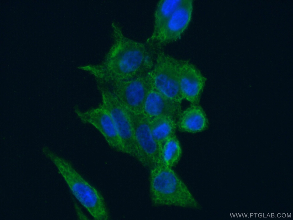 CAPRIN1 Monoclonal antibody