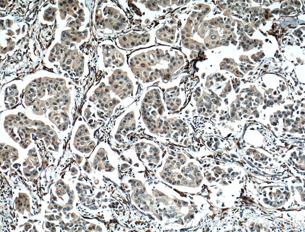 NUP155 Monoclonal antibody